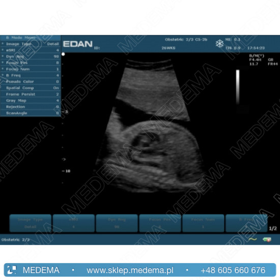 Ultrasonograf (USG) EDAN U2, stacjonarny,  kolor doppler