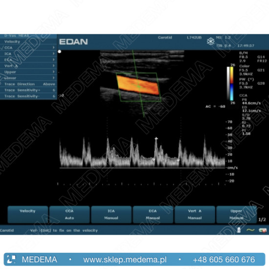 Ultrasonograf (USG) EDAN U50, kolor doppler
