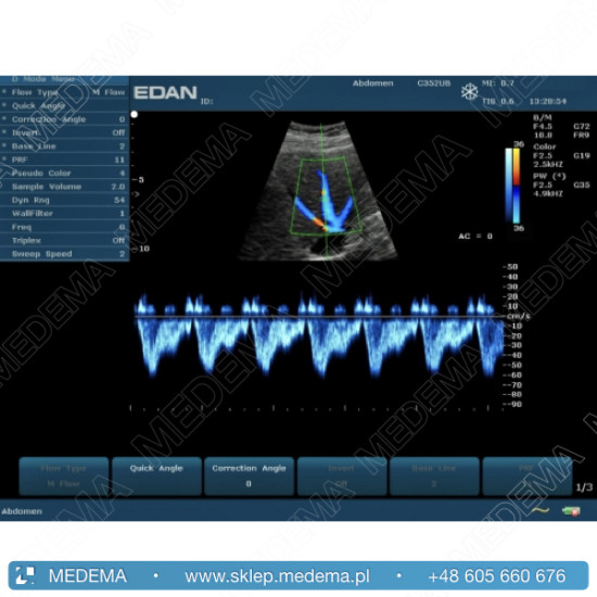Ultrasonograf (USG) EDAN U50, kolor doppler